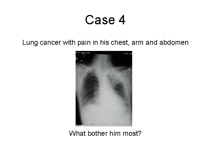 Case 4 Lung cancer with pain in his chest, arm and abdomen What bother Case 4 Lung cancer with pain in his chest, arm and abdomen What bother
