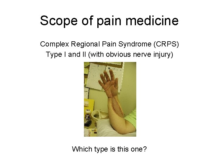 Scope of pain medicine Complex Regional Pain Syndrome (CRPS) Type I and II (with Scope of pain medicine Complex Regional Pain Syndrome (CRPS) Type I and II (with