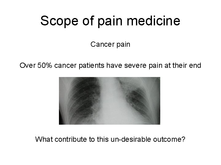 Scope of pain medicine Cancer pain Over 50% cancer patients have severe pain at Scope of pain medicine Cancer pain Over 50% cancer patients have severe pain at