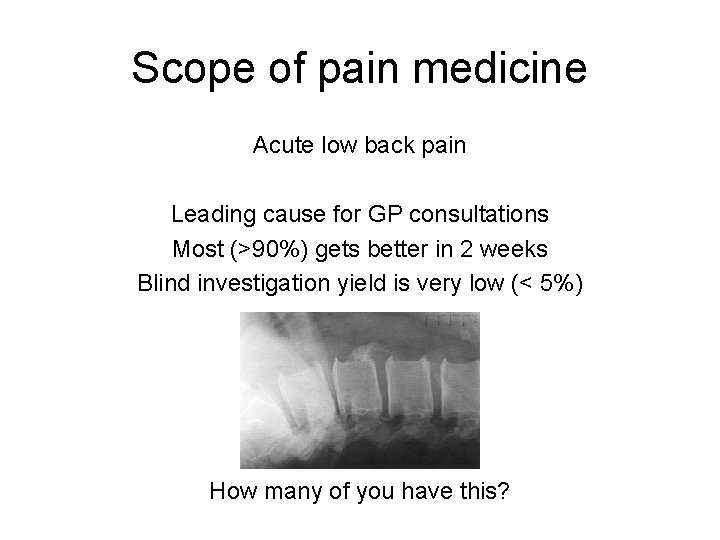 Scope of pain medicine Acute low back pain Leading cause for GP consultations Most Scope of pain medicine Acute low back pain Leading cause for GP consultations Most
