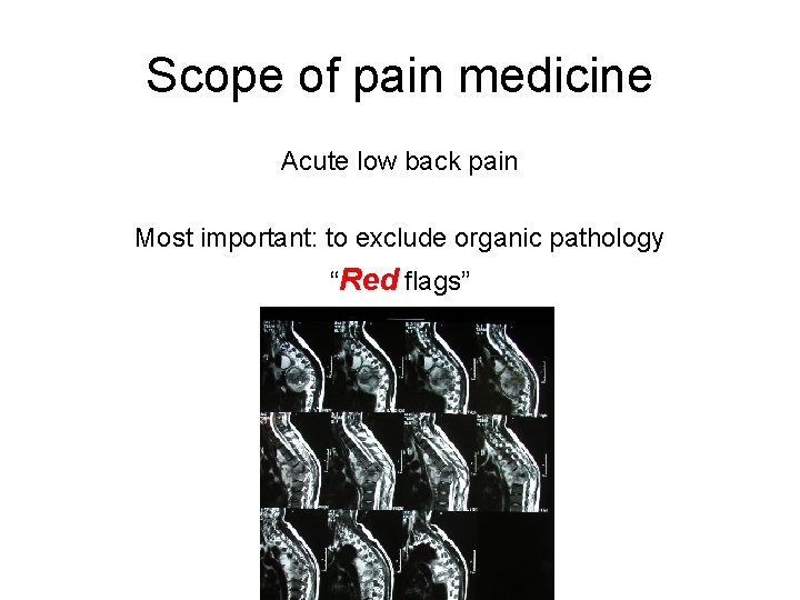Scope of pain medicine Acute low back pain Most important: to exclude organic pathology Scope of pain medicine Acute low back pain Most important: to exclude organic pathology