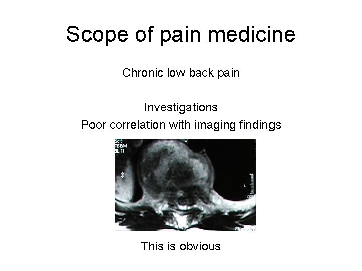 Scope of pain medicine Chronic low back pain Investigations Poor correlation with imaging findings Scope of pain medicine Chronic low back pain Investigations Poor correlation with imaging findings