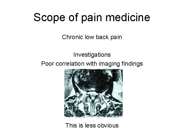 Scope of pain medicine Chronic low back pain Investigations Poor correlation with imaging findings Scope of pain medicine Chronic low back pain Investigations Poor correlation with imaging findings