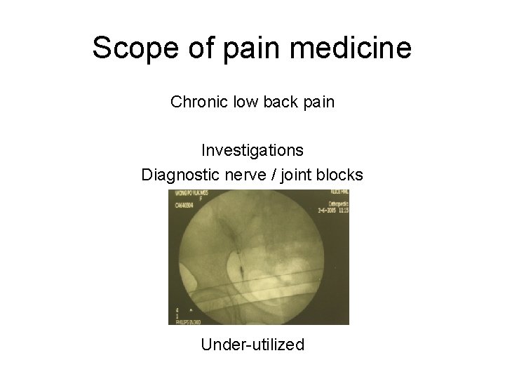 Scope of pain medicine Chronic low back pain Investigations Diagnostic nerve / joint blocks Scope of pain medicine Chronic low back pain Investigations Diagnostic nerve / joint blocks