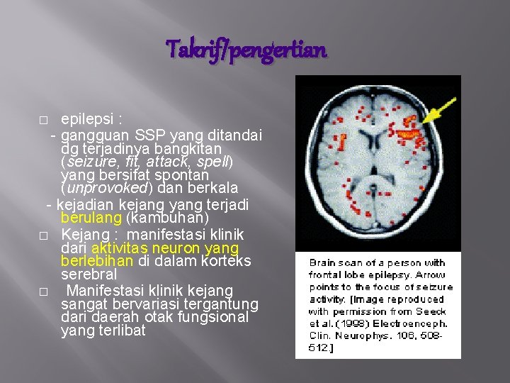 Takrif/pengertian epilepsi : - gangguan SSP yang ditandai dg terjadinya bangkitan (seizure, fit, attack,