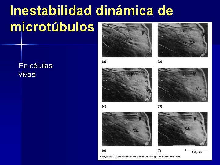 Inestabilidad dinámica de microtúbulos En células vivas 