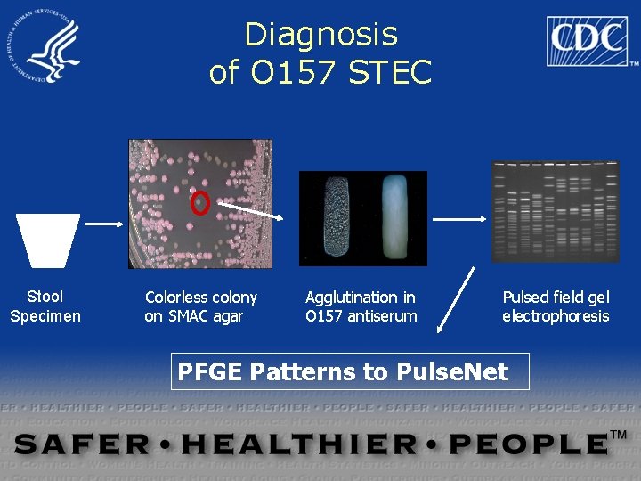 Diagnosis of O 157 STEC Stool Specimen Colorless colony on SMAC agar Agglutination in Diagnosis of O 157 STEC Stool Specimen Colorless colony on SMAC agar Agglutination in