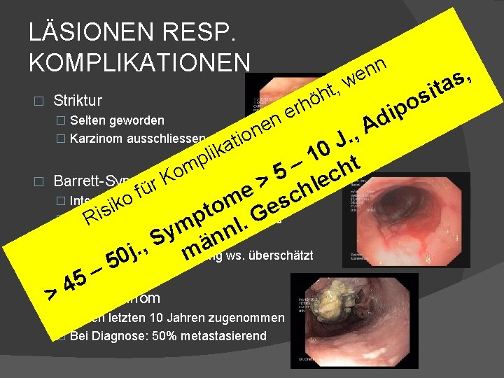 LÄSIONEN RESP. KOMPLIKATIONEN � Striktur n n e � Selten geworden rh e n