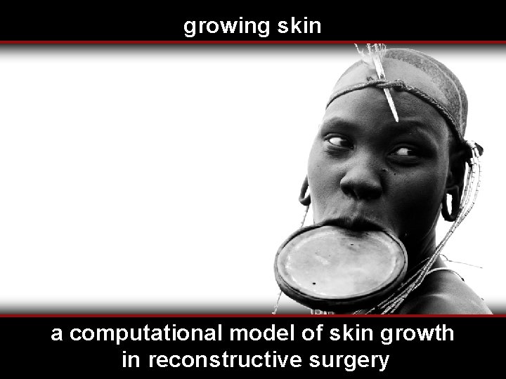 growing skin serdar göktepe*, jonathan wong**, ellen kuhl** *department of civil engineering, middle east