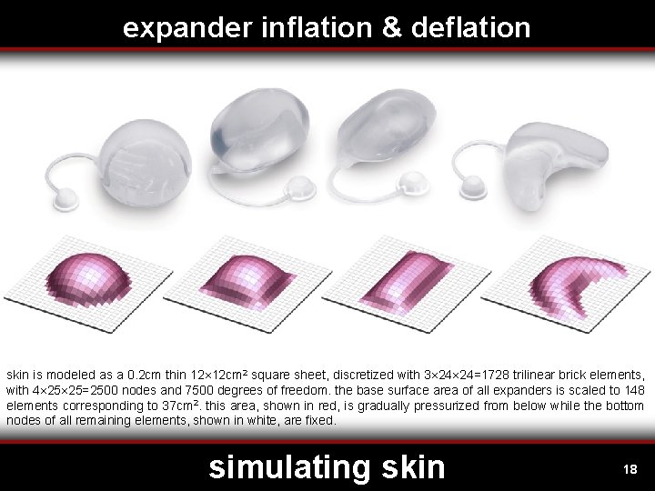 expander inflation & deflation skin is modeled as a 0. 2 cm thin 12