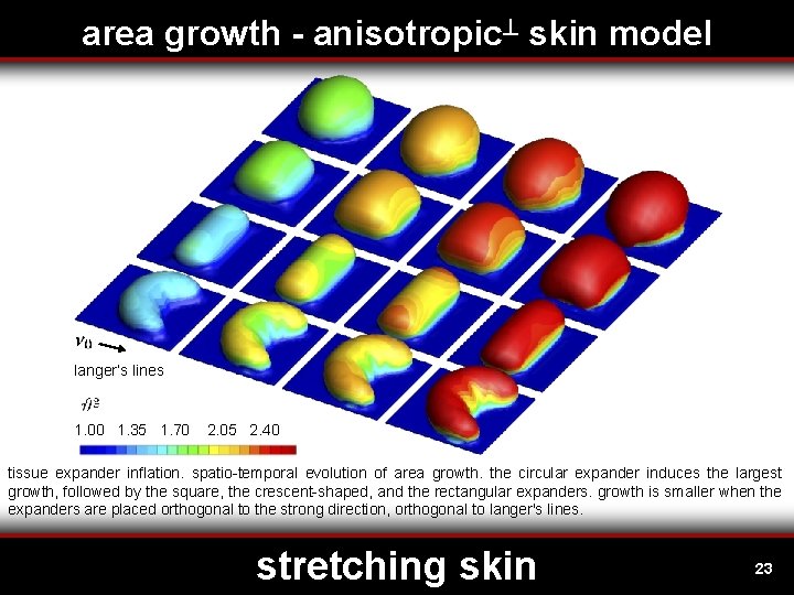 area growth - anisotropic skin model langer’s lines 1. 00 1. 35 1. 70