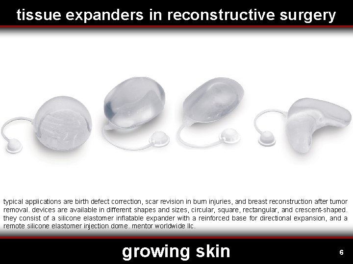 tissue expanders in reconstructive surgery typical applications are birth defect correction, scar revision in