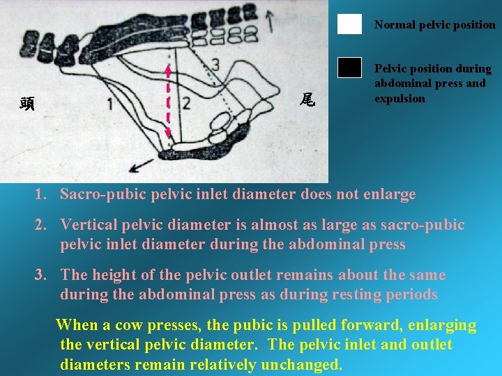 Normal pelvic position 頭 尾 Pelvic position during abdominal press and expulsion 1. Sacro-pubic Normal pelvic position 頭 尾 Pelvic position during abdominal press and expulsion 1. Sacro-pubic