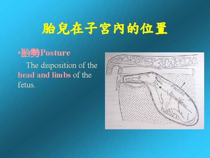 胎兒在子宮內的位置 • 胎勢Posture The disposition of the head and limbs of the fetus. 胎兒在子宮內的位置 • 胎勢Posture The disposition of the head and limbs of the fetus.