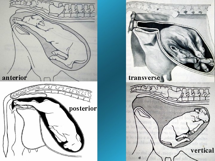 anterior transverse posterior vertical anterior transverse posterior vertical