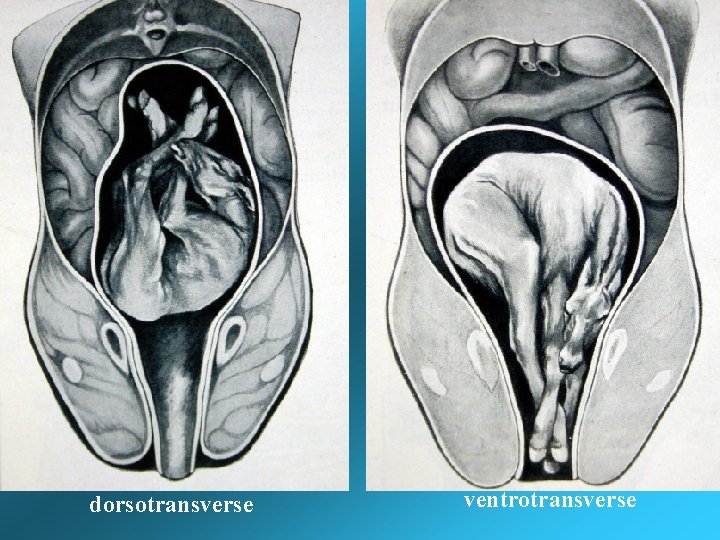 dorsotransverse ventrotransverse dorsotransverse ventrotransverse