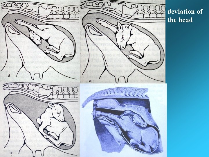 deviation of the head deviation of the head