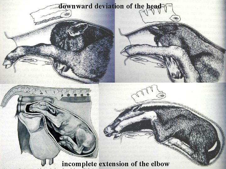 downward deviation of the head incomplete extension of the elbow downward deviation of the head incomplete extension of the elbow