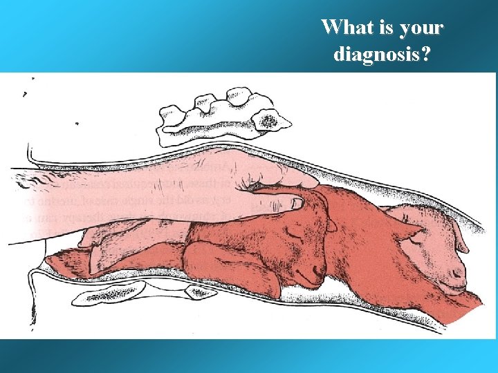 What is your diagnosis? What is your diagnosis?