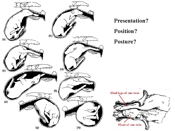 Presentation? Position? Posture? Presentation? Position? Posture?