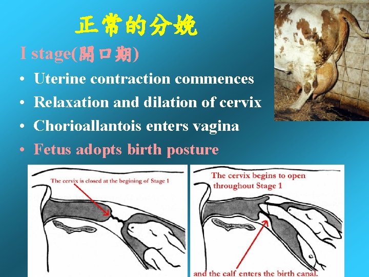 正常的分娩 I stage(開口期) • • Uterine contraction commences Relaxation and dilation of cervix Chorioallantois 正常的分娩 I stage(開口期) • • Uterine contraction commences Relaxation and dilation of cervix Chorioallantois