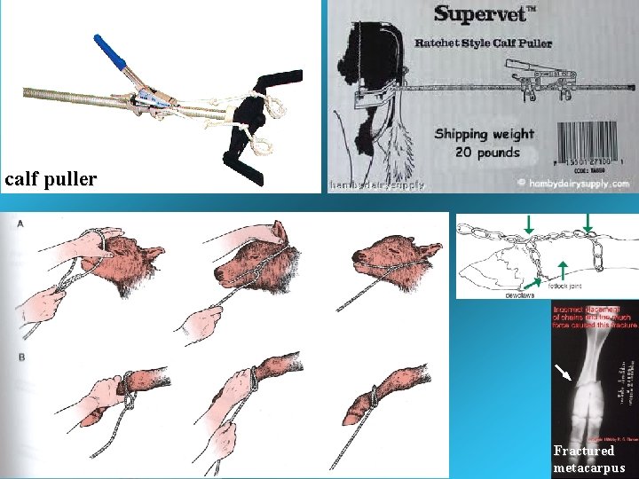 calf puller calfing rope Fractured metacarpus calf puller calfing rope Fractured metacarpus