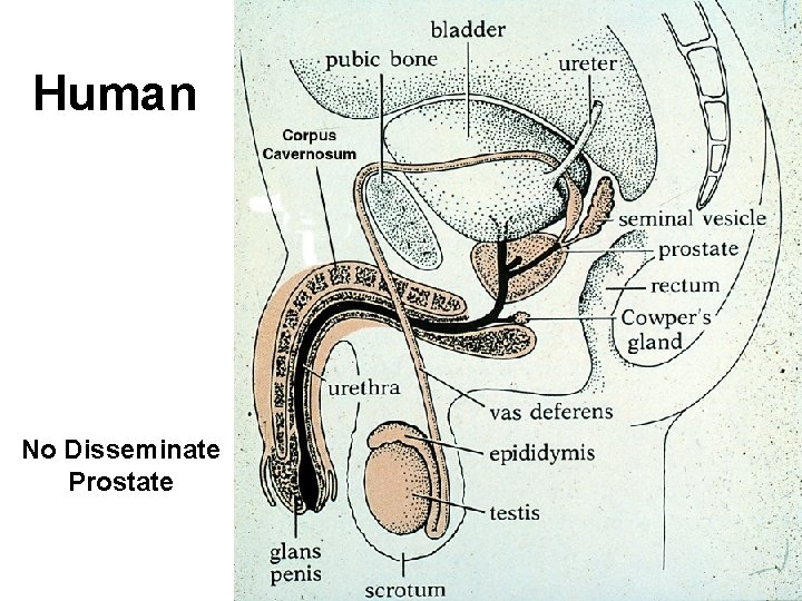 Human No Disseminate Prostate Human No Disseminate Prostate