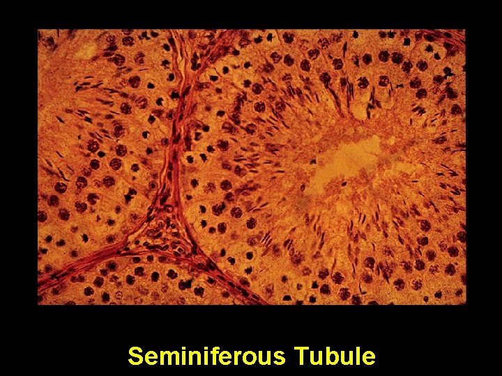Seminiferous Tubule Seminiferous Tubule