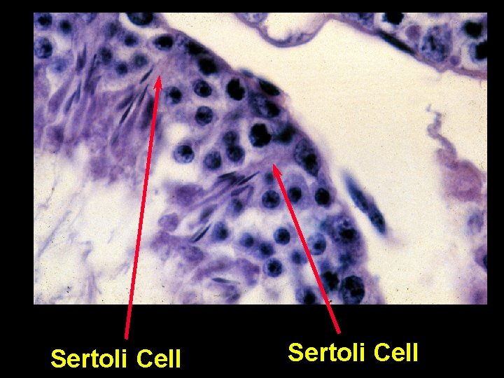 Sertoli Cell Sertoli Cell