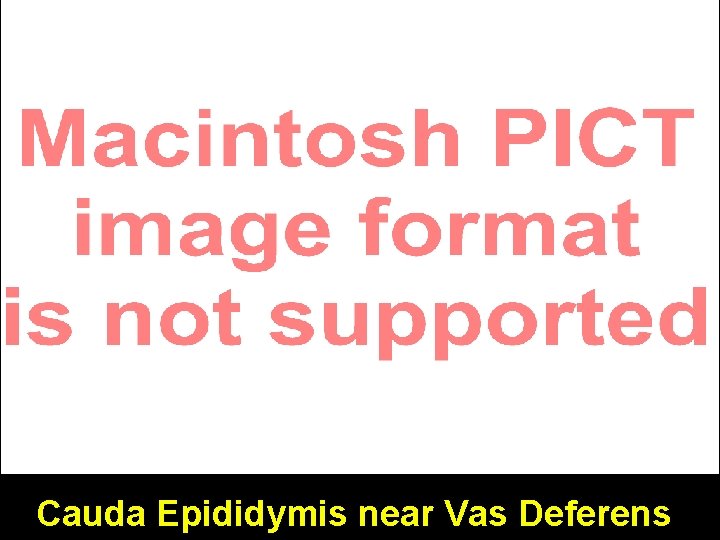 Cauda Epididymis near Vas Deferens Cauda Epididymis near Vas Deferens