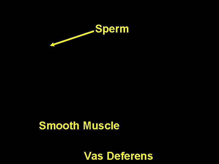 Sperm Smooth Muscle Vas Deferens Sperm Smooth Muscle Vas Deferens
