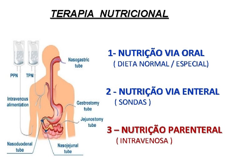 TERAPIA NUTRICIONAL 1 - NUTRIÇÃO VIA ORAL ( DIETA NORMAL / ESPECIAL) 2 - TERAPIA NUTRICIONAL 1 - NUTRIÇÃO VIA ORAL ( DIETA NORMAL / ESPECIAL) 2 -