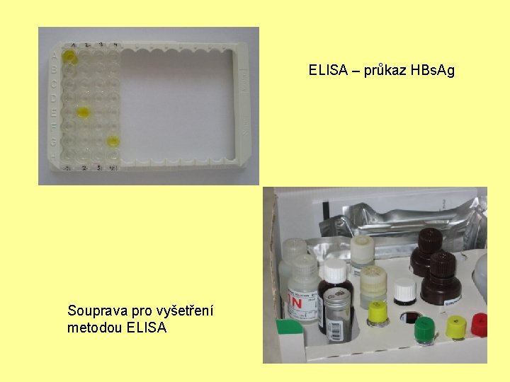 ELISA – průkaz HBs. Ag Souprava pro vyšetření metodou ELISA 