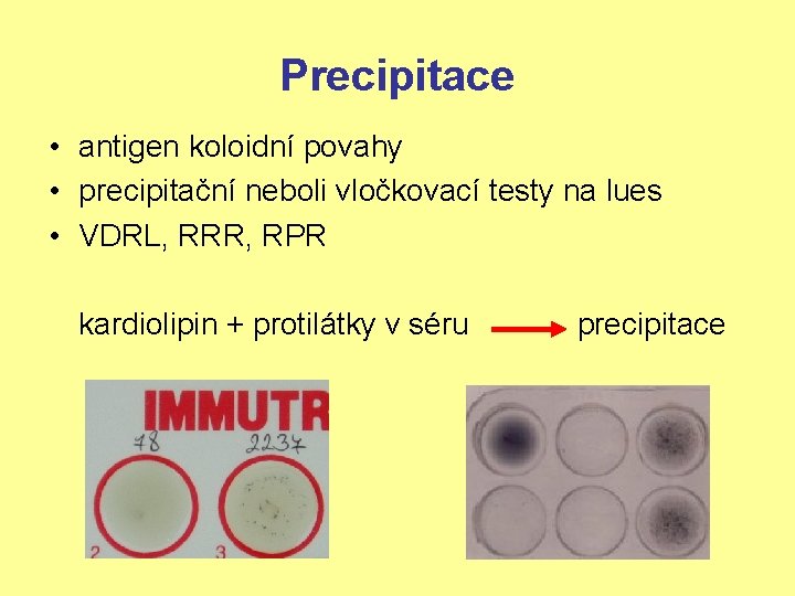 Precipitace • antigen koloidní povahy • precipitační neboli vločkovací testy na lues • VDRL,