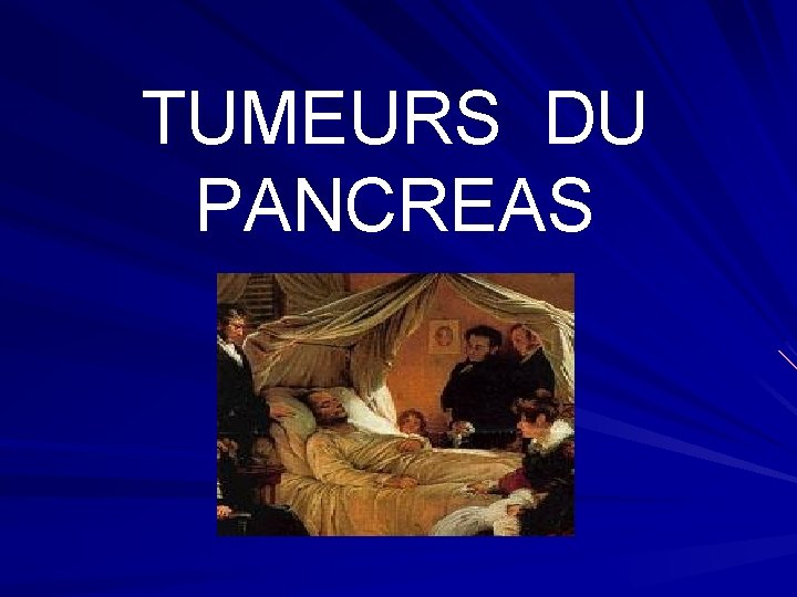 TUMEURS DU PANCREAS 