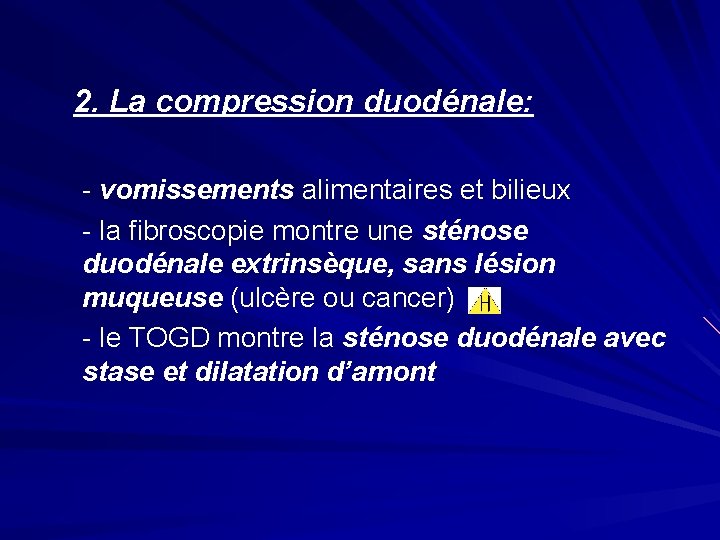  2. La compression duodénale: - vomissements alimentaires et bilieux - la fibroscopie montre
