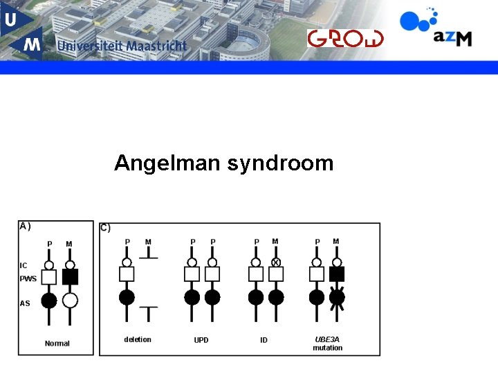 Angelman syndroom 