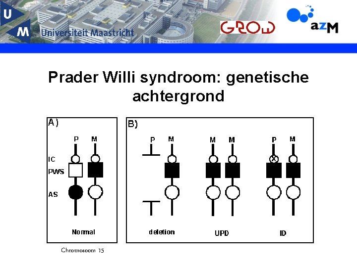Prader Willi syndroom: genetische achtergrond Chromosoom 15 