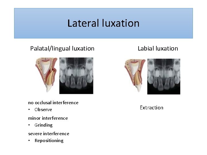Lateral luxation Palatal/lingual luxation no occlusal interference • Observe minor interference • Grinding severe