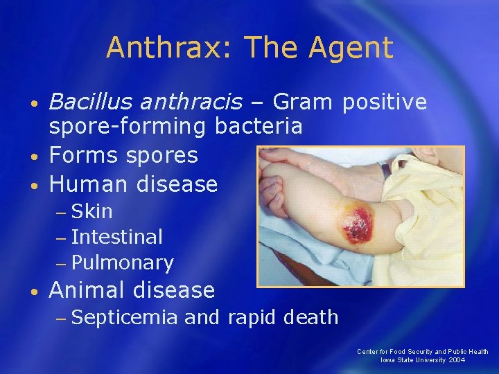 Anthrax: The Agent Bacillus anthracis – Gram positive spore-forming bacteria • Forms spores •