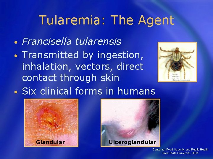 Tularemia: The Agent Francisella tularensis • Transmitted by ingestion, inhalation, vectors, direct contact through