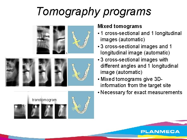 Tomography programs Mixed tomograms • 1 cross-sectional and 1 longitudinal images (automatic) • 3