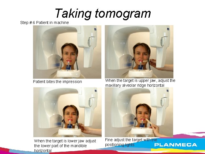 Taking tomogram Step # 6 Patient in machine Patient bites the impression When the