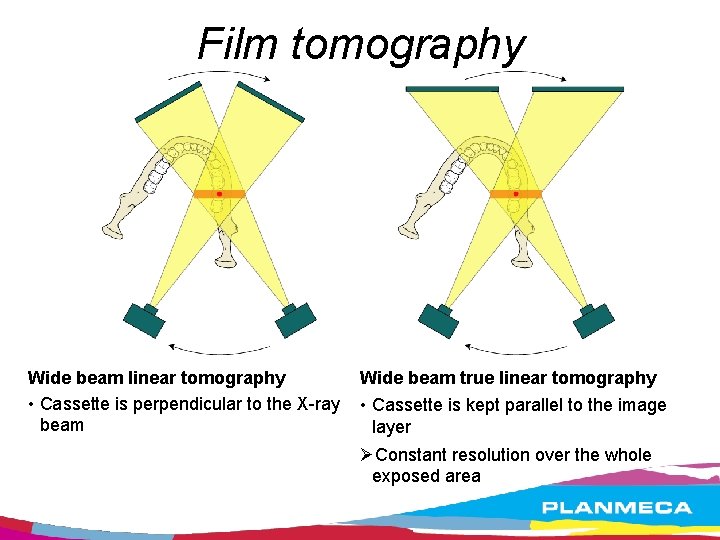 Film tomography Wide beam linear tomography • Cassette is perpendicular to the X-ray beam