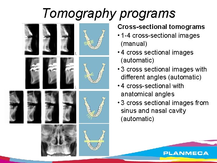 Tomography programs Cross-sectional tomograms • 1 -4 cross-sectional images (manual) • 4 cross sectional