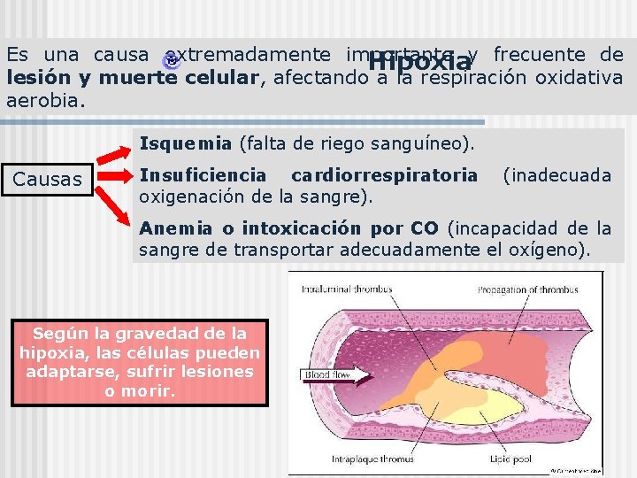 Es una causa extremadamente importante y frecuente de Hipoxia lesión y muerte celular, afectando