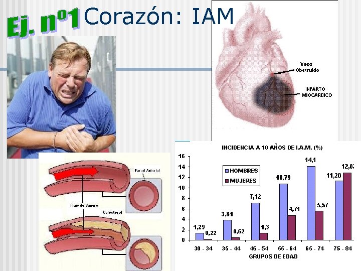 Corazón: IAM 