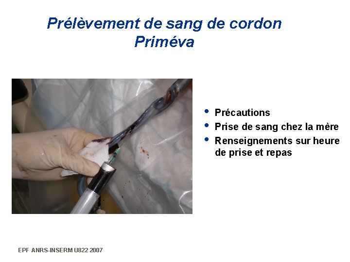 Prélèvement de sang de cordon Priméva i Précautions i Prise de sang chez la