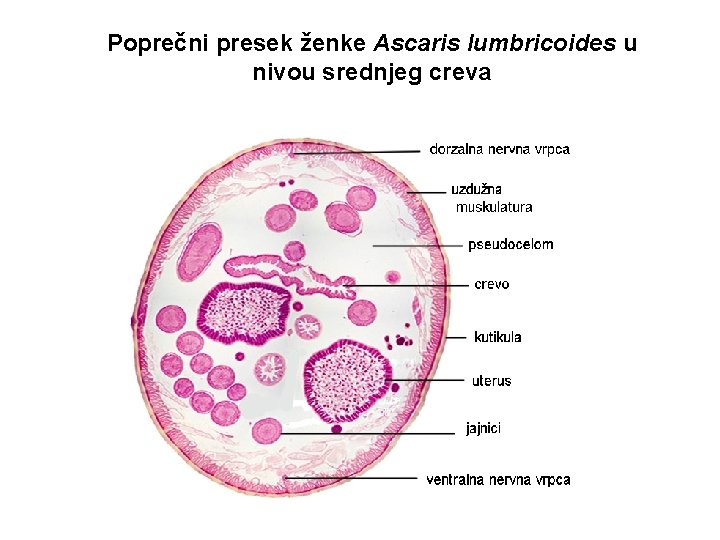 Poprečni presek ženke Ascaris lumbricoides u nivou srednjeg creva 