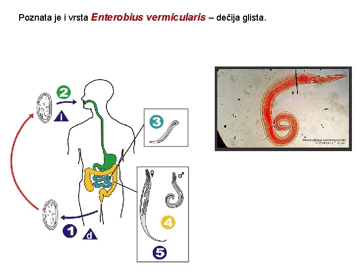 enterobius vermicularis glista